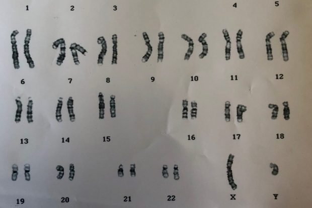 A micro graph image of Emmas Chromosomes, clearly showing the last pair to be XY